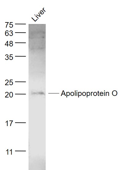 Liver lysates probed with Apolipoprotein O Polyclonal Antibody, Unconjugated (bs-12502R) at 1:1000 dilution and 4˚C overnight incubation. Followed by conjugated secondary antibody incubation at 1:20000 for 60 min at 37˚C.