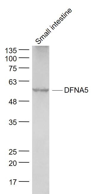 Small intestine lysates probed with DFNA5 Polyclonal Antibody, Unconjugated (bs-14286R) at 1:1000 dilution and 4˚C overnight incubation. Followed by conjugated secondary antibody incubation at 1:20000 for 60 min at 37˚C.