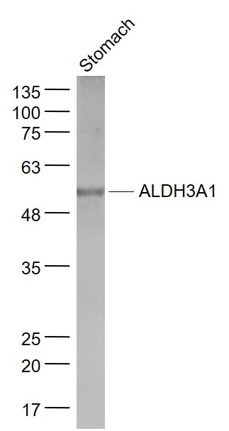 Stomach lysates probed with ALDH3A1 Polyclonal Antibody, Unconjugated (bs-15496R) at 1:1000 dilution and 4˚C overnight incubation. Followed by conjugated secondary antibody incubation at 1:20000 for 60 min at 37˚C.