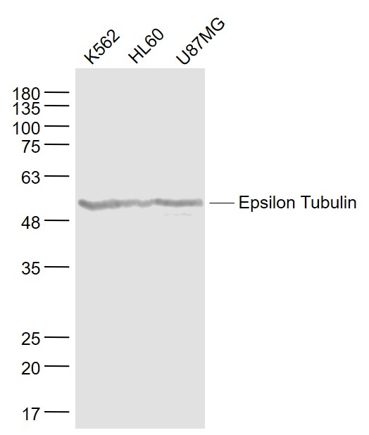 Lane 1: K562 cell lysates;Lane 2: HL60 cell lysates; Lane 3: U8MG cell lysates probed with Epsilon Tubulin Polyclonal Antibody, Unconjugated (bsm-33314M) at 1:1000 dilution and 4˚C overnight incubation. Followed by conjugated secondary antibody incubation at 1:20000 for 60 min at 37˚C.
