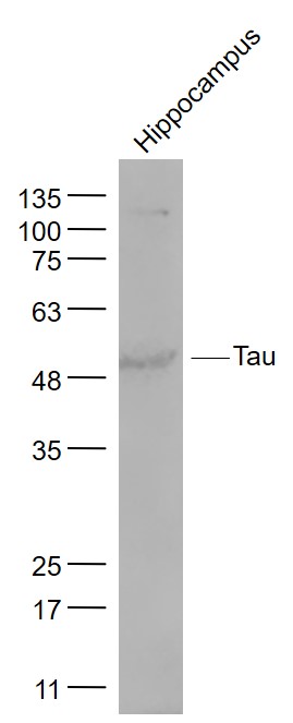 Hippocampus lysates probed with Tau Polyclonal Antibody, Unconjugated (bs-0157R) at 1:1000 dilution and 4˚C overnight incubation. Followed by conjugated secondary antibody incubation at 1:20000 for 60 min at 37˚C.