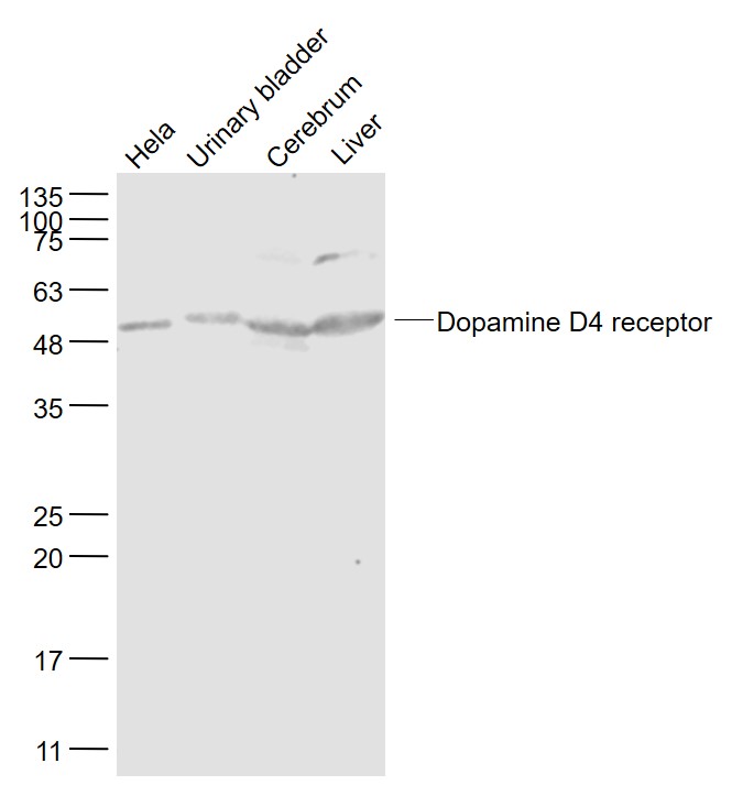 Lane 1: Hela cell lysates;Lane 2: Mouse urinary bladder lysates;Lane 3: Mouse Cerebrum lysates; Lane 4:Mouse Liver lysates probed with DRD4 Polyclonal Antibody, Unconjugated (bs-1746R) at 1:1000 dilution and 4˚C overnight incubation. Followed by conjugated secondary antibody incubation at 1:20000 for 60 min at 37˚C. Lane 1: Hela cell lysates;Lane 2: Mouse urinary bladder lysates;Lane 3: Mouse Cerebrum lysates; Lane 4:Mouse Liver lysates probed with DRD4 Polyclonal Antibody, Unconjugated (bs-1746R) at 1:1000 dilution and 4˚C overnight incubation. Followed by conjugated secondary antibody incubation at 1:20000 for 60 min at 37˚C.