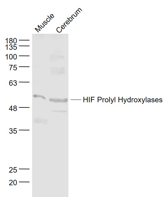 Lane 1:Mouse muscle lysates; Lane 2:Mouse Cerebrum lysates probed with P4HTM Polyclonal Antibody, Unconjugated (bs-1871R) at 1:1000 dilution and 4˚C overnight incubation. Followed by conjugated secondary antibody incubation at 1:20000 for 60 min at 37˚C.