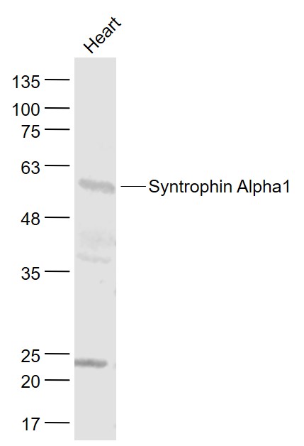 Heart lysates probed with Syntrophin/SNTA1/Syntrophin Alpha1 Polyclonal Antibody, Unconjugated (bs-3600R) at 1:1000 dilution and 4˚C overnight incubation. Followed by conjugated secondary antibody incubation at 1:20000 for 60 min at 37˚C.