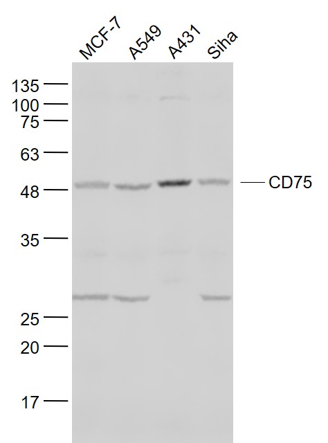 Lane 1: MCF-7 cell lysates;Lane 2: A549 cell lysates;Lane 3: A431 cell lysates; Lane 4: Siha cell lysates probed with CD75 Polyclonal Antibody, Unconjugated (bs-3793R) at 1:1000 dilution and 4˚C overnight incubation. Followed by conjugated secondary antibody incubation at 1:20000 for 60 min at 37˚C.