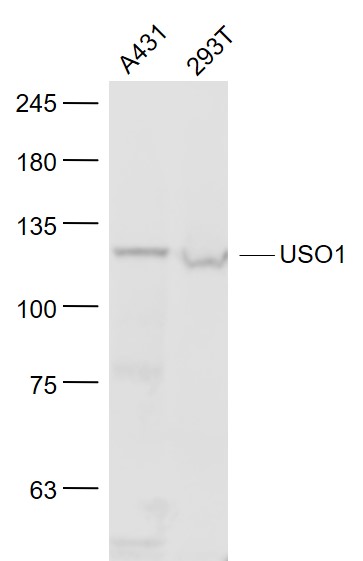 Lane 1: A431 cell lysates; Lane 2: 293T cell lysates probed with Vesicle docking protein p115 Polyclonal Antibody, Unconjugated (bs-4258R) at 1:1000 dilution and 4˚C overnight incubation. Followed by conjugated secondary antibody incubation at 1:20000 for 60 min at 37˚C.