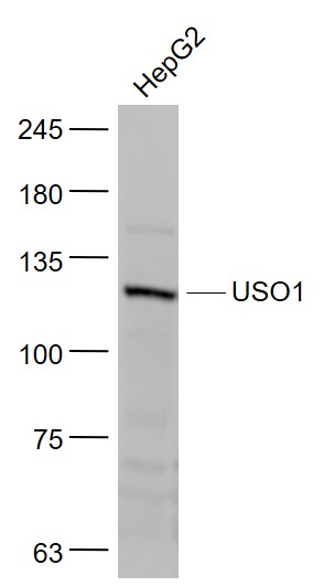 HepG2 cell lysates probed with Vesicle docking protein p115 Polyclonal Antibody, Unconjugated (bs-4258R) at 1:1000 dilution and 4˚C overnight incubation. Followed by conjugated secondary antibody incubation at 1:20000 for 60 min at 37˚C.