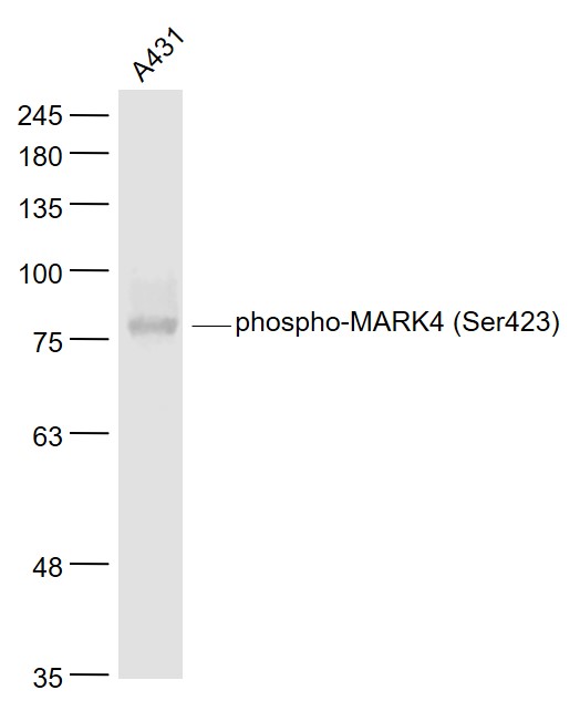 A431 cell lysates probed with MARK4(Ser423) Polyclonal Antibody, Unconjugated (bs-4660R) at 1:1000 dilution and 4˚C overnight incubation. Followed by conjugated secondary antibody incubation at 1:20000 for 60 min at 37˚C.