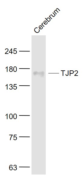 Brain cerebrum lysates probed with TJP2 Polyclonal Antibody, Unconjugated (bs-4844R) at 1:1000 dilution and 4˚C overnight incubation. Followed by conjugated secondary antibody incubation at 1:20000 for 60 min at 37˚C.