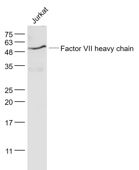 Jurkat cell lysates probed with Factor 7 Polyclonal Antibody, Unconjugated (bs-4846R) at 1:1000 dilution and 4˚C overnight incubation. Followed by conjugated secondary antibody incubation at 1:20000 for 60 min at 37˚C.