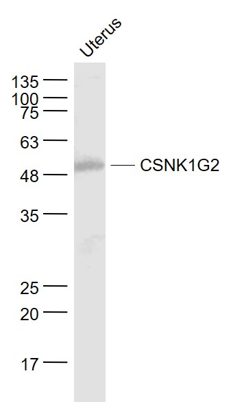 Uterus lysates probed with CSNK1G2 Polyclonal Antibody, Unconjugated (bs-5053R) at 1:1000 dilution and 4˚C overnight incubation. Followed by conjugated secondary antibody incubation at 1:20000 for 60 min at 37˚C.