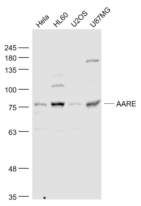 Lane 1: Hela cell lysates;Lane 2: Hl60 cell lysates;Lane 3: U2OS cell lysates; Lane 4: U87mg cell lysates probed with AARE Polyclonal Antibody, Unconjugated (bs-5983R) at 1:1000 dilution and 4°C overnight incubation. Followed by conjugated secondary antibody incubation at 1:20000 for 60 min at 37°C.