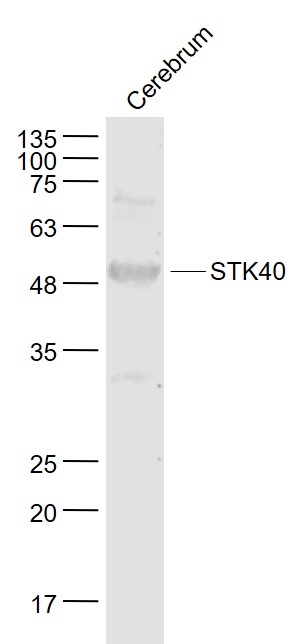 Mouse cerebrum lysates probed with STK40 Polyclonal Antibody, Unconjugated (bs-6899R) at 1:1000 dilution and 4˚C overnight incubation. Followed by conjugated secondary antibody incubation at 1:20000 for 60 min at 37˚C.
