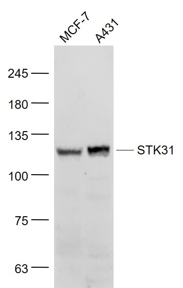 Lane 1: MCF-7 cell lysates; Lane 2: A431 cell lysates probed with STK31 Polyclonal Antibody, Unconjugated (bs-7015R) at 1:1000 dilution and 4˚C overnight incubation. Followed by conjugated secondary antibody incubation at 1:20000 for 60 min at 37˚C.