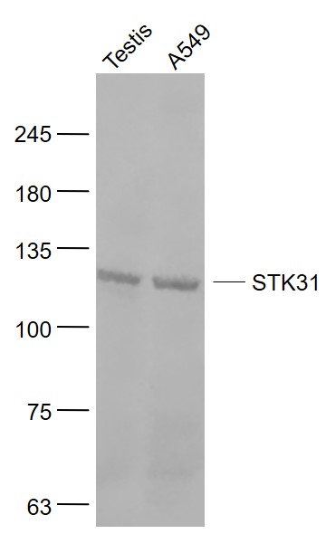 Lane 1: Mouse testis lysates; Lane 2: A549 cell lysates probed with STK31 Polyclonal Antibody, Unconjugated (bs-7015R) at 1:1000 dilution and 4˚C overnight incubation. Followed by conjugated secondary antibody incubation at 1:20000 for 60 min at 37˚C.