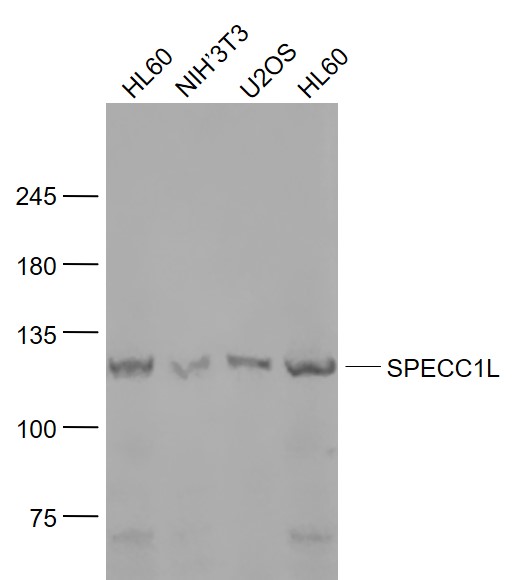 Lane 1: HL60 Cells; Lane 2: NIH/3T3 Cells; Lane 3: U2OS Cells; Lane 4: HL60 Cells; Probed with SPECC1L Monoclonal Antibody (bs-7773R) at 1:1000 overnight at 4°C followed by a conjugated secondary antibody for 60 minutes at 37°C.