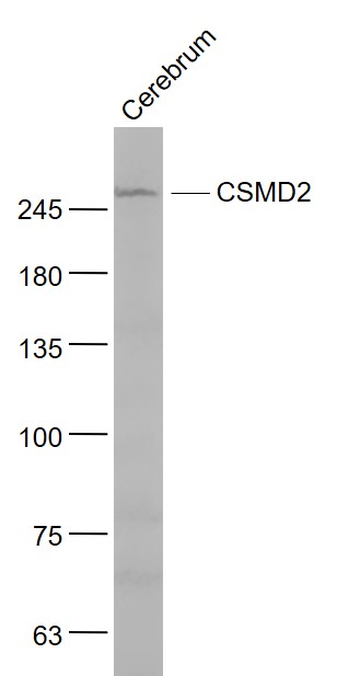 Mouse cerebrum lysates probed with CSMD2 Polyclonal Antibody, Unconjugated (bs-8187R) at 1:1000 dilution and 4˚C overnight incubation. Followed by conjugated secondary antibody incubation at 1:20000 for 60 min at 37˚C.