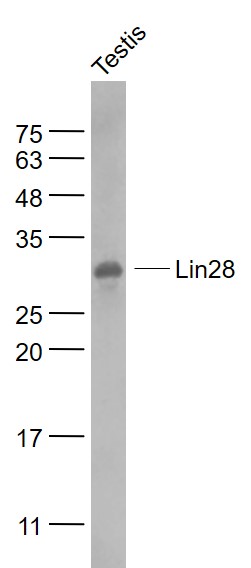 Mouse testis lysates probed with Lin28A/B Polyclonal Antibody, Unconjugated (bs-8443R) at 1:1000 dilution and 4˚C overnight incubation. Followed by conjugated secondary antibody incubation at 1:20000 for 60 min at 37˚C.