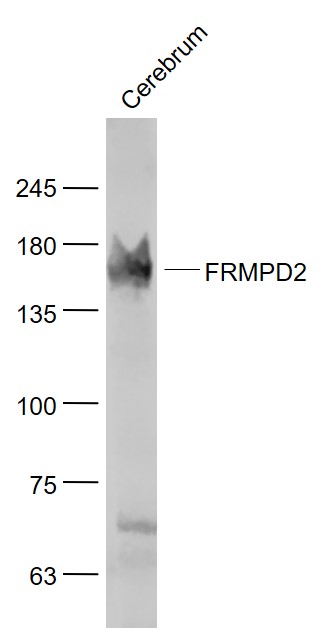 Cerebrum lysates probed with PDZK4 Polyclonal Antibody, Unconjugated (bs-9038R) at 1:1000 dilution and 4˚C overnight incubation. Followed by conjugated secondary antibody incubation at 1:20000 for 60 min at 37˚C.