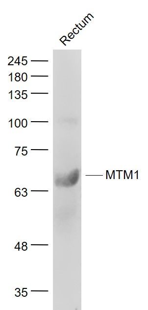 Rectum lysates probed with MTM1 Polyclonal Antibody, Unconjugated (bs-79178R) at 1:1000 dilution and 4˚C overnight incubation. Followed by conjugated secondary antibody incubation at 1:20000 for 60 min at 37˚C.