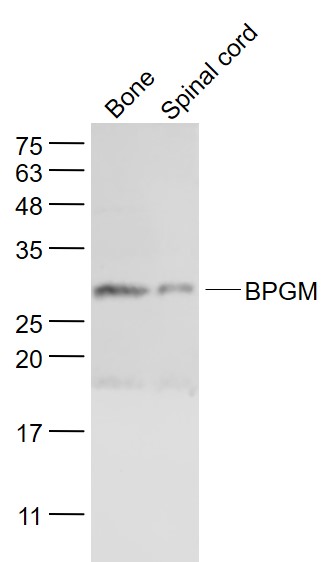 Mouse bone lysates probed with BPGM Polyclonal Antibody, Unconjugated (bs-9519R) at 1:1000 dilution and 4˚C overnight incubation. Followed by conjugated secondary antibody incubation at 1:20000 for 60 min at 37˚C.