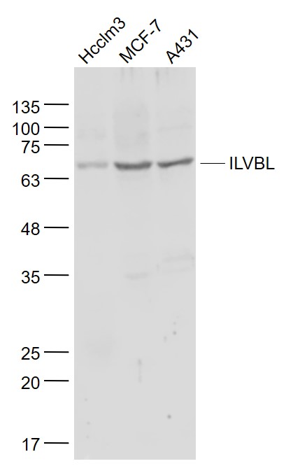 Lane 1: Hcclm3 cell lysates; Lane 2: MCF-7 cell lysates; Lane 3: A431 cell lysates probed with ILVBL Polyclonal Antibody, Unconjugated (bs-11014R) at 1:1000 dilution and 4˚C overnight incubation. Followed by conjugated secondary antibody incubation at 1:20000 for 60 min at 37˚C.