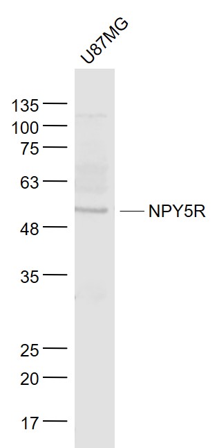 U87MG cell lysates probed with NPY5R Polyclonal Antibody, Unconjugated (bs-11521R) at 1:1000 dilution and 4˚C overnight incubation. Followed by conjugated secondary antibody incubation at 1:20000 for 60 min at 37˚C.