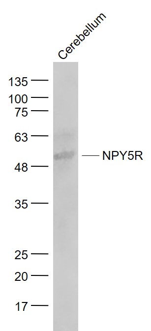 Mouse cerebellum lysates probed with NPY5R Polyclonal Antibody, Unconjugated (bs-11521R) at 1:1000 dilution and 4˚C overnight incubation. Followed by conjugated secondary antibody incubation at 1:20000 for 60 min at 37˚C.