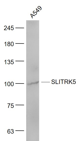 A549 cell lysates probed with SLITRK5 Polyclonal Antibody, Unconjugated (bs-11959R) at 1:1000 dilution and 4˚C overnight incubation. Followed by conjugated secondary antibody incubation at 1:20000 for 60 min at 37˚C.