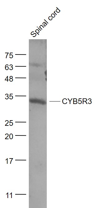 Mouse spinal cord lysates probed with CYB5R3 Polyclonal Antibody, Unconjugated (bs-12162R) at 1:1000 dilution and 4˚C overnight incubation. Followed by conjugated secondary antibody incubation at 1:20000 for 60 min at 37˚C.