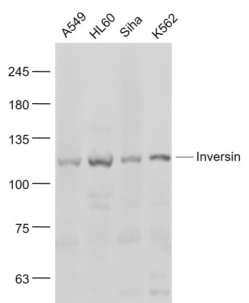Lane 1: A549 Cells; Lane 2: HL60 Cells; Lane 3: Siha Cells; Lane 4: K562 Cells; Probed with Inversin/Nephrocystin 2 Antibody (bs-12437R) at 1:1000 overnight at 4°C followed by a conjugated secondary antibody for 60 minutes at 37°C.
