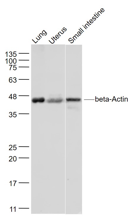 Lane 1: Mouse lung lysates;Lane 2: Mouse uterus lysates; Lane 3: Mouse small intestine lysates probed with beta Actin Polyclonal Antibody, Unconjugated (bs-0061R) at 1:1000 dilution and 4˚C overnight incubation. Followed by conjugated secondary antibody incubation at 1:20000 for 60 min at 37˚C.