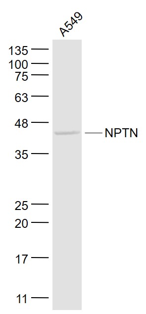A549 cell lysates probed with SDFR1/NPTN Polyclonal Antibody, Unconjugated (bs-1801R) at 1:1000 dilution and 4˚C overnight incubation. Followed by conjugated secondary antibody incubation at 1:20000 for 60 min at 37˚C.