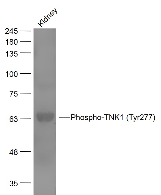 Mouse kidney lysates probed with TNK1 (Tyr277) Polyclonal Antibody, Unconjugated (bs-3450R) at 1:1000 dilution and 4˚C overnight incubation. Followed by conjugated secondary antibody incubation at 1:20000 for 60 min at 37˚C.