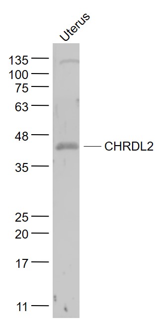 Mouse uterus lysates probed with CHRDL2 Polyclonal Antibody, Unconjugated (bs-3860R) at 1:1000 dilution and 4˚C overnight incubation. Followed by conjugated secondary antibody incubation at 1:20000 for 60 min at 37˚C.