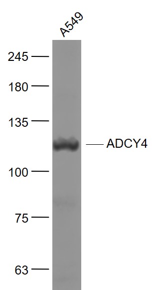 A549 cell lysates probed with ADCY4 Polyclonal Antibody, Unconjugated (bs-3921R) at 1:1000 dilution and 4˚C overnight incubation. Followed by conjugated secondary antibody incubation at 1:20000 for 60 min at 37˚C.