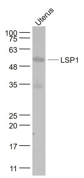 Mouse uterus lysates probed with LSP1 Polyclonal Antibody, Unconjugated (bs-5154R) at 1:1000 dilution and 4˚C overnight incubation. Followed by conjugated secondary antibody incubation at 1:20000 for 60 min at 37˚C.