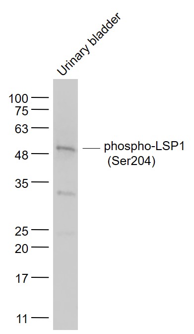 Mouse urinary bladder lysates probed with LSP1 (Ser204) Polyclonal Antibody, Unconjugated (bs-5155R) at 1:1000 dilution and 4˚C overnight incubation. Followed by conjugated secondary antibody incubation at 1:20000 for 60 min at 37˚C.