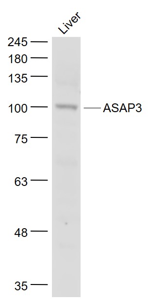 Mouse liver lysates probed with ASAP3 Polyclonal Antibody, Unconjugated (bs-5832R) at 1:1000 dilution and 4˚C overnight incubation. Followed by conjugated secondary antibody incubation at 1:20000 for 60 min at 37˚C.