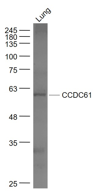 Mouse lung lysates probed with CCDC61 Polyclonal Antibody, Unconjugated (bs-8136R) at 1:1000 dilution and 4˚C overnight incubation. Followed by conjugated secondary antibody incubation at 1:20000 for 60 min at 37˚C. Mouse lung lysates probed with CCDC61 Polyclonal Antibody, Unconjugated (bs-8136R) at 1:1000 dilution and 4˚C overnight incubation. Followed by conjugated secondary antibody incubation at 1:20000 for 60 min at 37˚C.