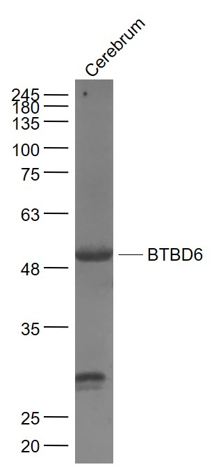 Cerebrum lysates probed with BTBD6 Polyclonal Antibody, Unconjugated (bs-8159R) at 1:1000 dilution and 4˚C overnight incubation. Followed by conjugated secondary antibody incubation at 1:20000 for 60 min at 37˚C.