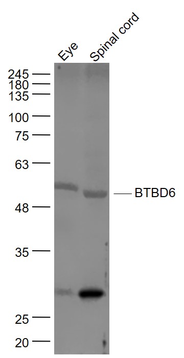 Lane 1: Mouse eye lysates; Lane 2: Mouse spinal cord lysates probed with BTBD6 Polyclonal Antibody, Unconjugated (bs-8159R) at 1:1000 dilution and 4˚C overnight incubation. Followed by conjugated secondary antibody incubation at 1:20000 for 60 min at 37˚C. Lane 1: Mouse eye lysates; Lane 2: Mouse spinal cord lysates probed with BTBD6 Polyclonal Antibody, Unconjugated (bs-8159R) at 1:1000 dilution and 4˚C overnight incubation. Followed by conjugated secondary antibody incubation at 1:20000 for 60 min at 37˚C.