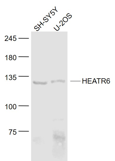 Lane 1: SH-SY5Y cell lysates; Lane 2: U-2OS cell lysates probed with HEATR6 Polyclonal Antibody, Unconjugated (bs-8321R) at 1:1000 dilution and 4˚C overnight incubation. Followed by conjugated secondary antibody incubation at 1:20000 for 60 min at 37˚C.
