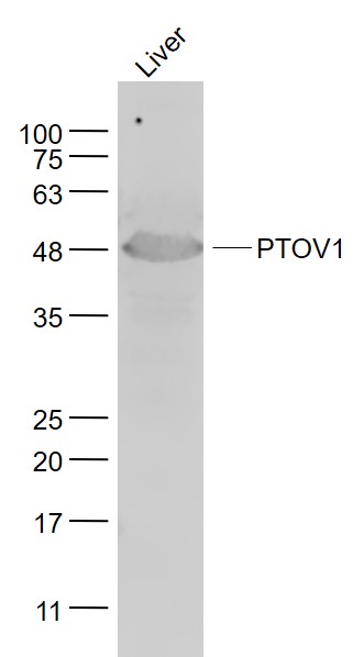 Mouse liver lysates probed with PTOV1 Polyclonal Antibody, Unconjugated (bs-10171R) at 1:1000 dilution and 4˚C overnight incubation. Followed by conjugated secondary antibody incubation at 1:20000 for 60 min at 37˚C.