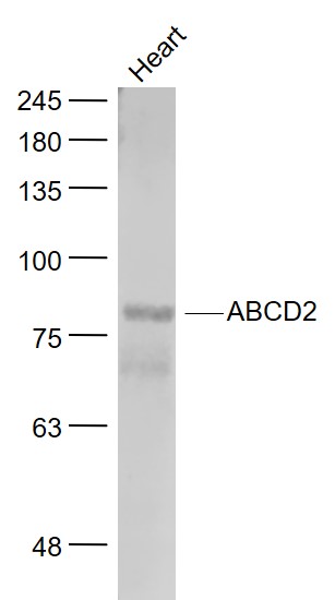 Mouse heart lysates probed with ABCD2 Polyclonal Antibody, Unconjugated (bs-10646R) at 1:1000 dilution and 4˚C overnight incubation. Followed by conjugated secondary antibody incubation at 1:20000 for 60 min at 37˚C.