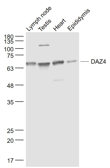 Lane 1: Mouse lymph node lysates; Lane 2: Mouse testis lysates; Lane 3: Mouse heart lysates; Lane 4: Mouse epididymis lysates probed with DAZ4 Polyclonal Antibody, Unconjugated (bs-13609R) at 1:1000 dilution and 4˚C overnight incubation. Followed by conjugated secondary antibody incubation at 1:20000 for 60 min at 37˚C.