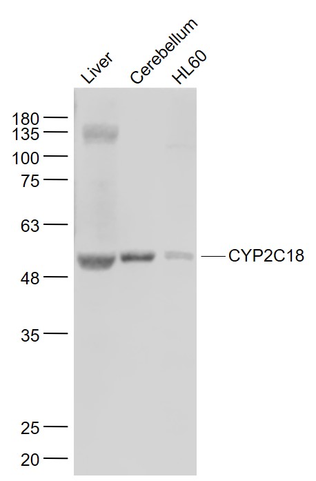 Lane 1:Mouse Liver lysates; Lane 2: Mouse Cerebrum ; Lane 3: HL60 cell lysates probed with CYP2C18 Polyclonal Antibody, Unconjugated (bs-14150R) at 1:1000 dilution and 4˚C overnight incubation. Followed by conjugated secondary antibody incubation at 1:20000 for 60 min at 37˚C. Lane 1:Mouse Liver lysates; Lane 2: Mouse Cerebrum ; Lane 3: HL60 cell lysates probed with CYP2C18 Polyclonal Antibody, Unconjugated (bs-14150R) at 1:1000 dilution and 4˚C overnight incubation. Followed by conjugated secondary antibody incubation at 1:20000 for 60 min at 37˚C.