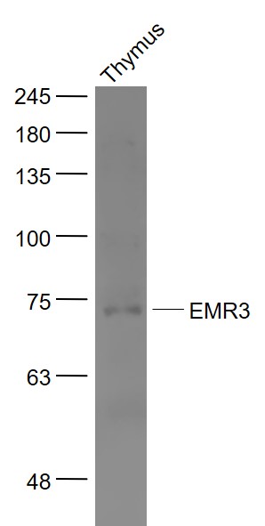 Mouse thymus lysates probed with EMR3 Polyclonal Antibody, Unconjugated (bs-14588R) at 1:1000 dilution and 4˚C overnight incubation. Followed by conjugated secondary antibody incubation at 1:20000 for 60 min at 37˚C.