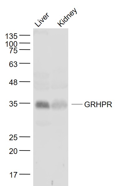 Lane 1: Mouse Liver lysates; Lane 2: Mouse kidney lysates probed with GRHPR Polyclonal Antibody, Unconjugated (bs-16314R) at 1:1000 dilution and 4˚C overnight incubation. Followed by conjugated secondary antibody incubation at 1:20000 for 60 min at 37˚C.