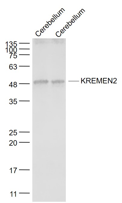 Lane 1:Mouse Cerebellum lysates; Lane 2: Rat Cerebellum lysates probed with KREMEN2 Polyclonal Antibody, Unconjugated (bs-16813R) at 1:1000 dilution and 4˚C overnight incubation. Followed by conjugated secondary antibody incubation at 1:20000 for 60 min at 37˚C.